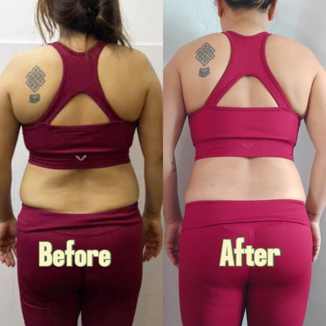 Before and After Weight Loss