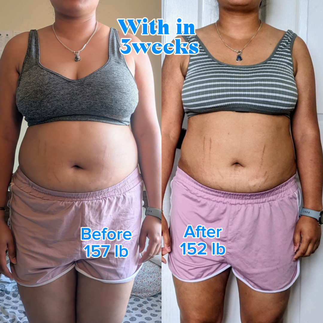 Before and After Weight Loss