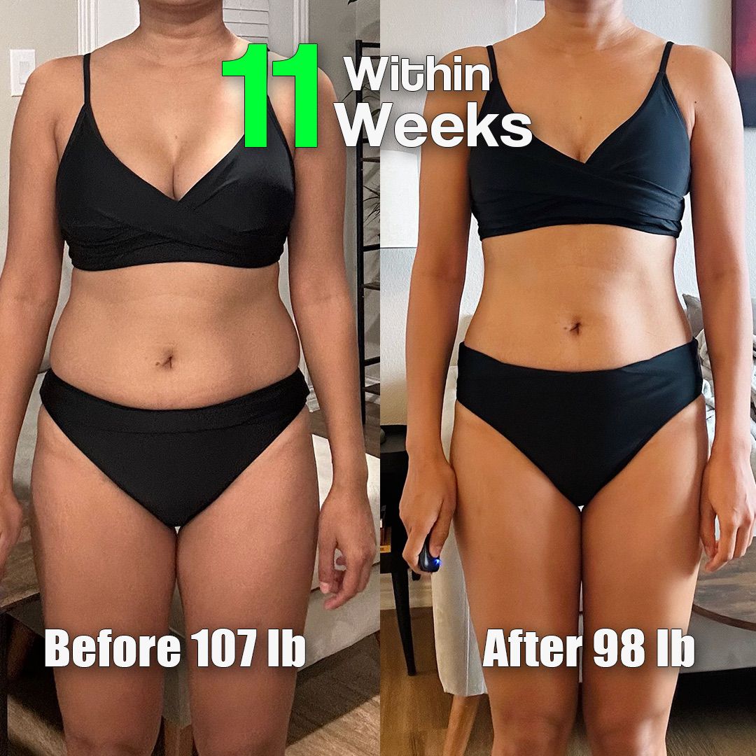 Before and After Weight Loss